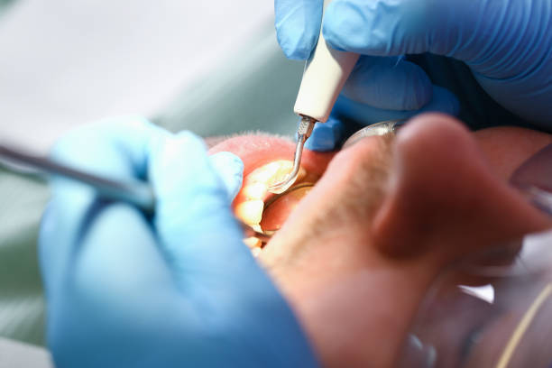 Best Orthodontic Emergency Dentist in Fortville, IN