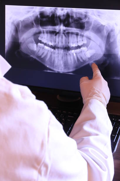 Best Holiday Emergency Dentist in Fortville, IN